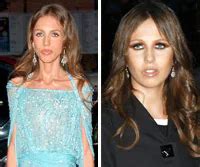 allegra versace antes y despues
